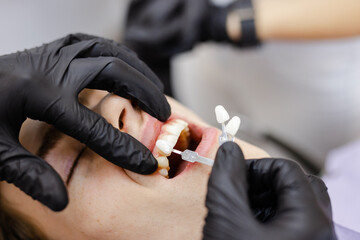 Incognito patient teeth stomatology veneer medical procedure beauty