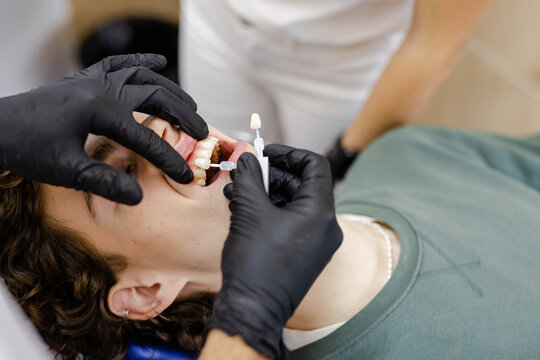 Anonymous orthodontist tooth colour template enamel patient 