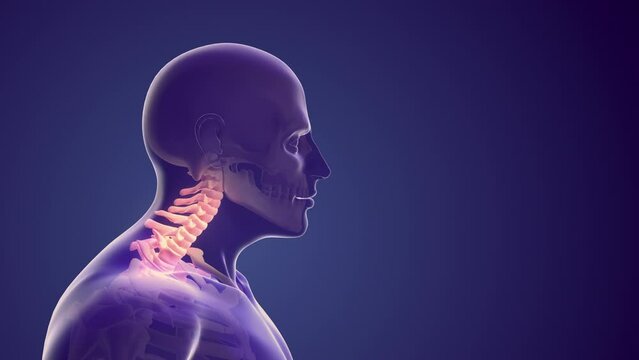 Cervical posture syndrome or neck discomfort