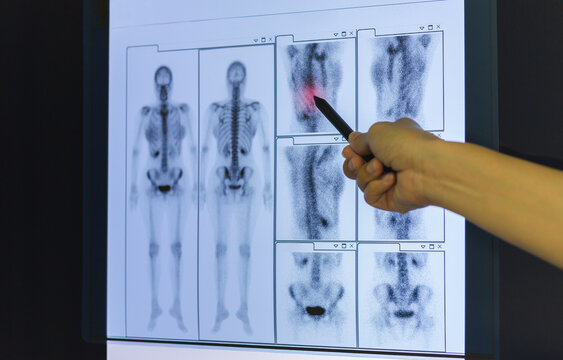 Doctor hand pointing on skeleton x-ray film.