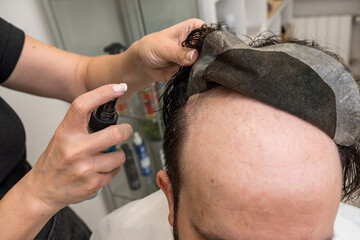 bald man changing his hair prosthesis wig in aesthetic center