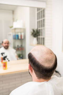 bald man waiting for his hair prosthesis to be placed in an esthetic c