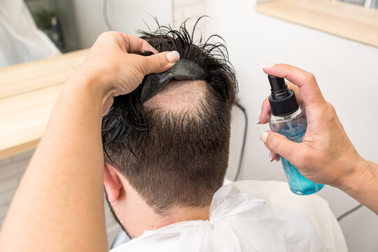 bald man with a wigbald man changing his hair prosthesis wig in esthet