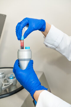doctor using blood centrifuge machine to obtain plasma