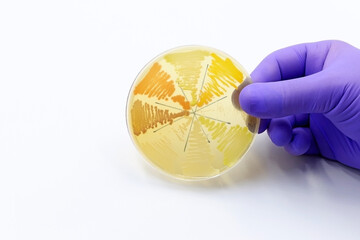 Colonies of bacteria isolated in a Petri dish in the Microbiology laboratory