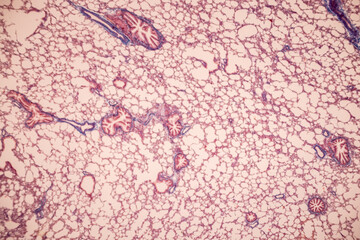Human lung pathology under light microscope, The lungs is organs of the respiratory system in humans.
