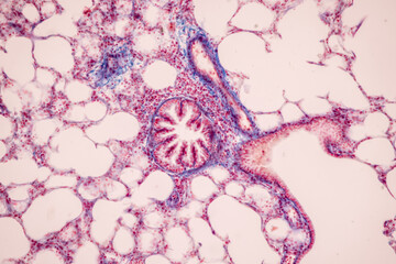 Human lung pathology under light microscope, The lungs is organs of the respiratory system in...