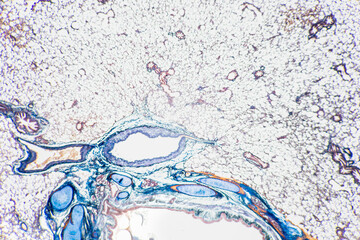 Human lung pathology under light microscope, The lungs is organs of the respiratory system in...