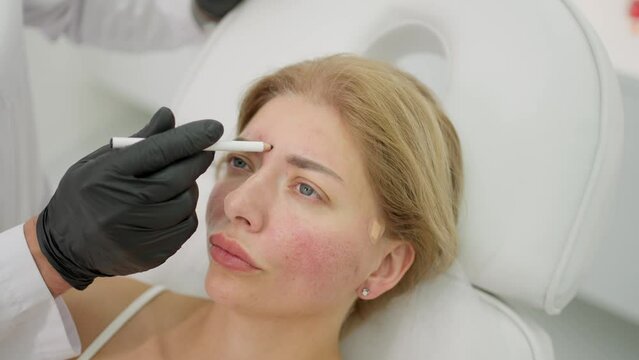A beautician injects geluronic acid into a client's face