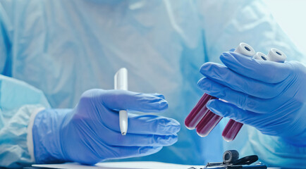 Blood test. Clinic laboratory. Nurse studying serum samples recording results with hands in medical protective rubber gloves with tubes and pen.