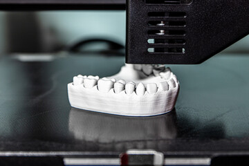 dental prostheses from the 3d printer - obrazy, fototapety, plakaty