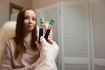 Plasma treatment, plasmolifting or PRP method point the introduction of the patient's own plasma...