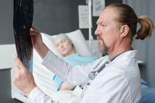 Side view of mature serious oncologist or radiologist looking at MRI scan image of patient brain while standing against young woman in bed