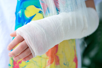 Close-up of a broken arm of a child in a cast. The girl holds her hand bent - obrazy, fototapety, plakaty