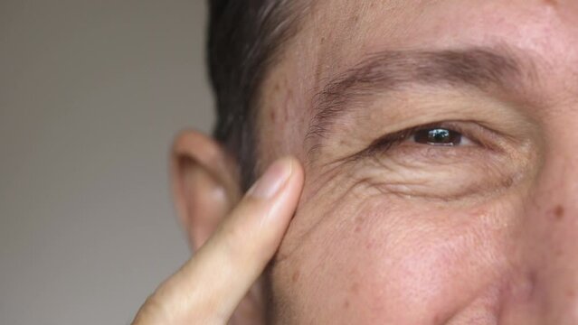 Serious middle-aged man examining wrinkles in eyes area, looking at camera, skin is aging and needs cosmetic skincare products. 4K