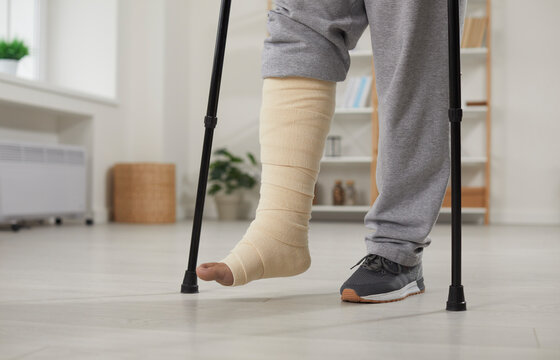 Man with broken leg in cast walking with crutches at home. Shot of plastered leg and crutches, selective focus. Bone fracture, injury, trauma, recovery, rehabilitation concept