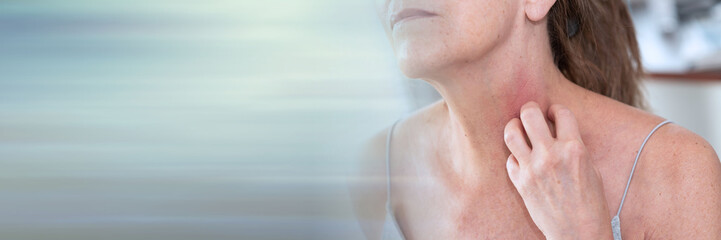 Woman having itchy and scratching her arm; panoramic banner