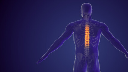 Spinal pain or back pain medical background