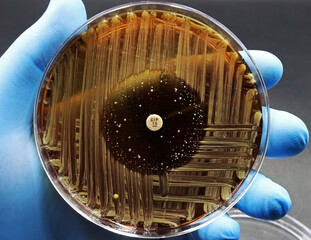 Hand of scientist or doctor showing a microbiological culture Petri dish with bacteria, where an...