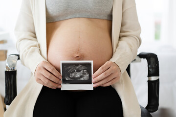 Close up hand ultrasound to help check the pregnancy for mother that the child is developing in the womb that is growing. And saw the image of the child moving in the womb