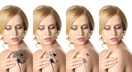 Collage with photo of woman on white background showing tattoo removal process
