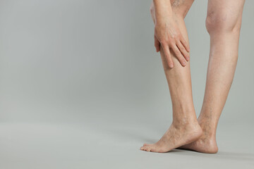 Closeup view of woman suffering from varicose veins on light grey background. Space for text