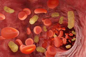 Red blood cells and yellow bacteria flowing in blood vessel. Illustration of the concept of a severe medical condition sepsis in which bacteria enter the blood - obrazy, fototapety, plakaty