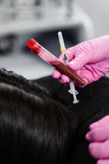 Cosmetologist with test tube with blood and plasma for PRP Platelet Rich Plasma procedure. Platelet...