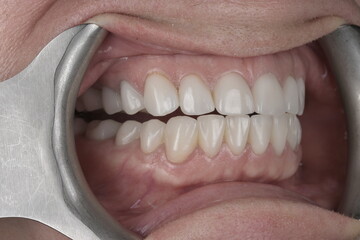 Enchanting Dental Masterpieces: Unveiling Captivating Images of Dental Perfection