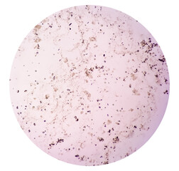 Bacteria colony on culture media plate, stool culture
