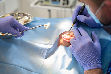 Surgeon who performs surgery on patient ear using ultrasonic knife