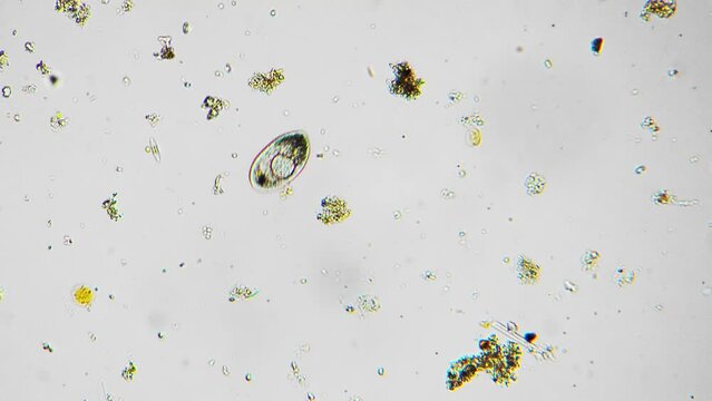 Infusoria Billeder – Gennemse 1,166 stockfotos, vektorer og videoer ...