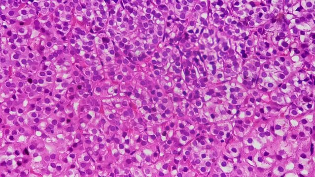 Human adrenal gland under microscope 400x against bright field background. Macro footage of people organ showing different layers of cells and membranes. Producing steroid hormones. Healthcare theme