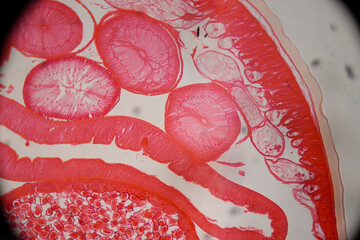 photo of human parasite worms under the microscope