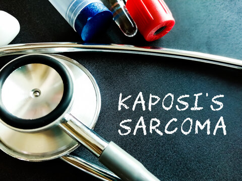 Kaposi's sarcoma, a type of cancer that forms in the lining of blood and lymph vessels. Medical conceptual image.