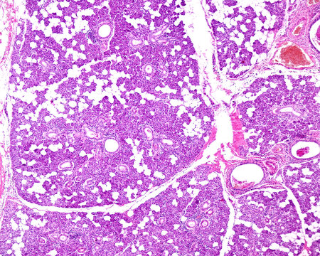 Human parotid gland