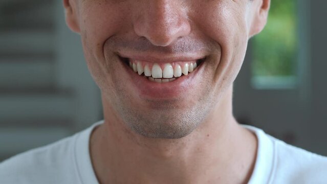 Close up view lower part face of young man, smiles in front of camera, revealing demonstrating teeth. Happy man smiling, show healthy white teeth satisfied with dental treatment at dentist clinic
