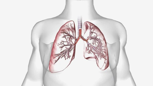 Cystic fibrosis (CF) is an inherited disease that causes thickened mucus to form in the lungs, pancreas and other organs