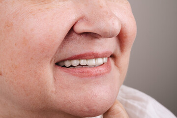 Obraz premium A Captivating Smile: Unleashing the Power of a Transformed Confidence