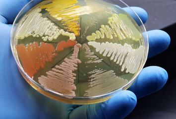 The rise of antibiotic-resistant bacterial infections. One hand holds a Petri dish with a culture...