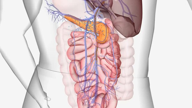 Normally, glucose (sugar) is absorbed into the bloodstream and the pancreas releases insulin in response.