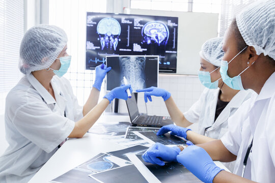 young female doctor student internship team group meeting and discussing about brain cancer surgery treatment patient case at the lab office in hospital. healthcare and medical education concept.