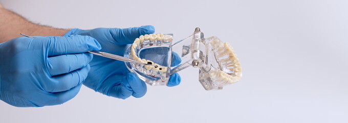 Dental technician holding a dental jaw model on a white backgro