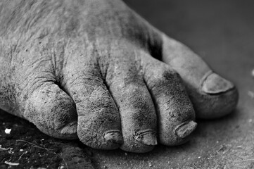 limbs of human feet of old men 
