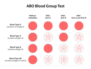 ABO Blood Group Test