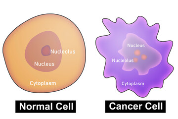 Cancer cell and normal cell comparison