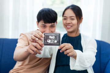 pregnant woman carefully looking at ultrasound film with his lover look happy family preparation ideas Marriage and couple concept.