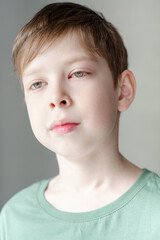 portrait of a boy of European appearance with a red eye from conjunctivitis, on a white background