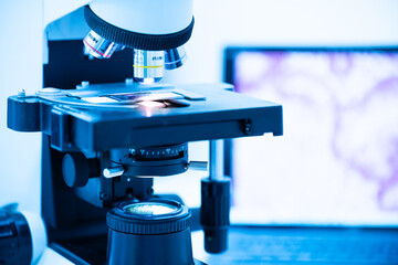 Modern microscope and human tissue section slide with computer monitor show glandular image.Medical...