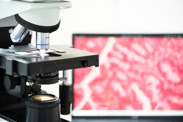 Modern microscope and human tissue section slide with computer monitor show glandular image.Medical patholology and cytology technology concept.Selective focus.